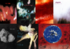The Cure’s Best-Sounding Songs for Headphone Testing